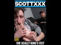 The Scally King's Feet